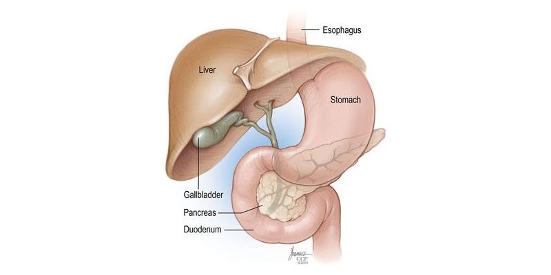 Gall Stone Removal in Bangalore