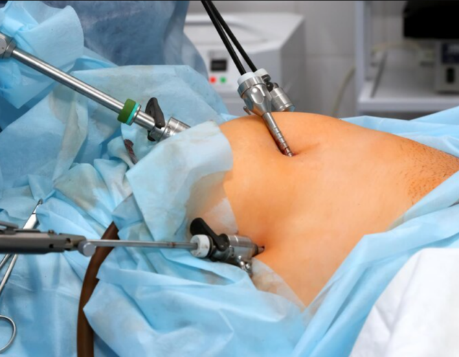 Minimally Invasive vs. Traditional Surgery: Which is Right for You?