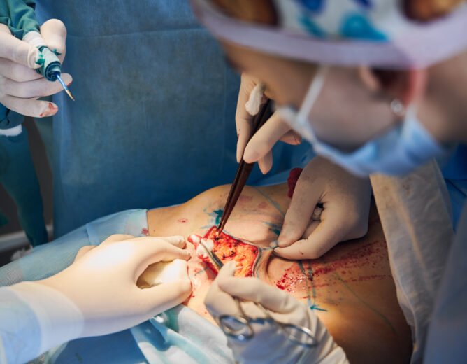 Minimally Invasive vs. Traditional Surgery: Which is Right for You?