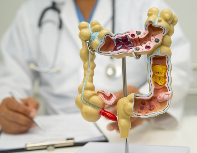 Rising Cases of Early-Onset Colorectal Cancer: What Patients Need to Know